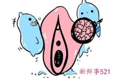 外阴白斑是什么样的