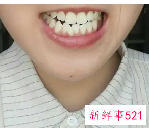 每天都刷牙牙齿还是越来越黄