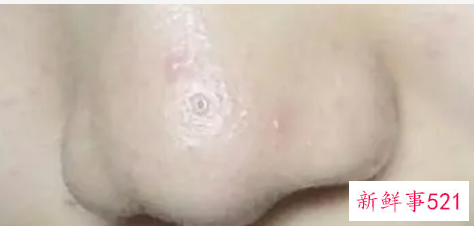 挤出来的油脂有臭味