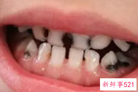 避免宝宝有蛀牙注意七件事