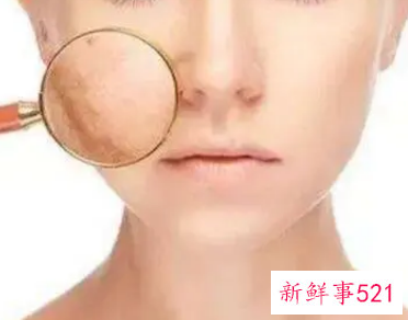 怎么改善脸色暗黄