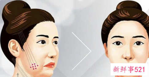 全脸提升紧致用什么方法效果好