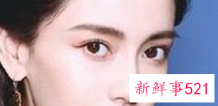 各种脸型适合的双眼皮