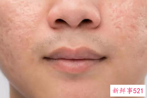 使皮肤紧致的方法有哪些