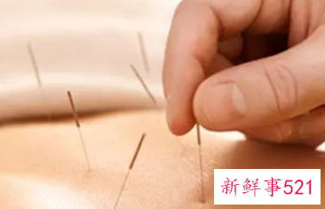 针灸的功效与作用