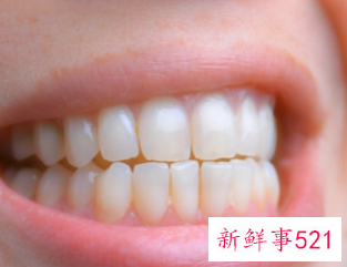 每天都刷牙牙齿还是越来越黄
