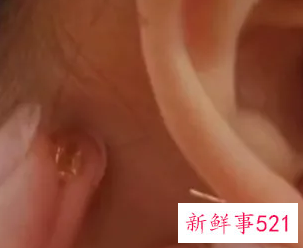 耳钉后面有两个塞子应该带哪一个