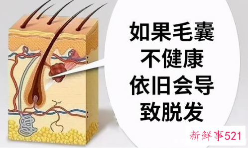 一般植发能维持多久