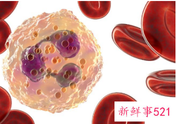 轻度地贫最迟几岁发病