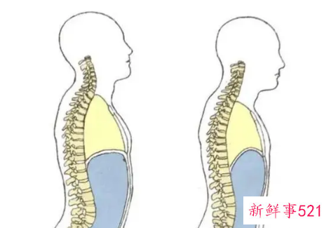 人睡觉平躺好还是有侧身睡好