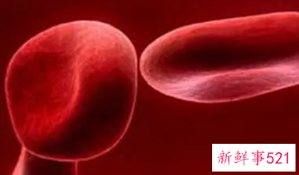 轻度地贫最迟几岁发病