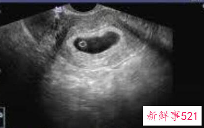 b超单有这个一般是女孩