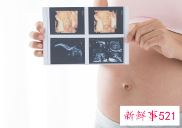 b超单有这个一般是女孩