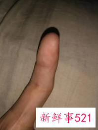 运动完手指不灵活