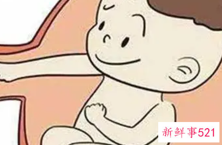 剖宫分娩的注意事项