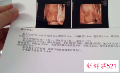 b超单有这个一般是女孩