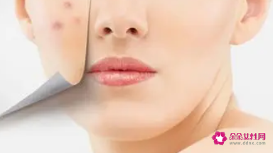 肌肤压力的表现有哪些