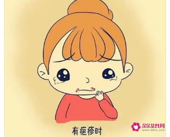 嘴角起泡用什么药膏好得快