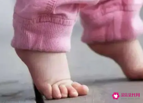 婴儿学走路脚尖走咋办