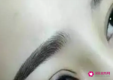 绣眉后1至7天的变化