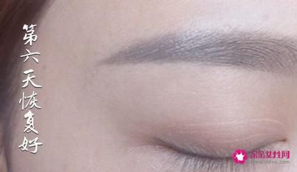 绣眉后1至7天的变化