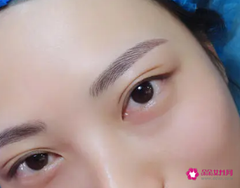 绣眉后1至7天的变化