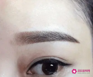 绣眉后1至7天的变化