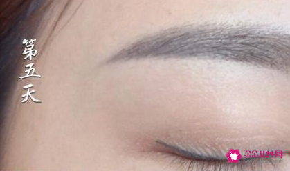 绣眉后1至7天的变化
