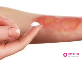 腿上的疤痕怎么消除