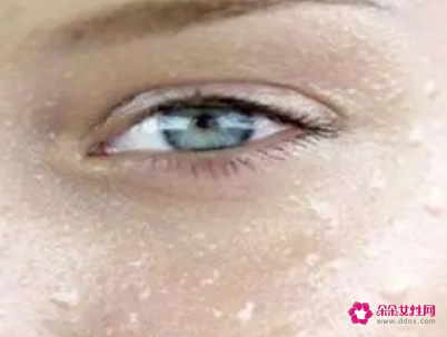 皮肤总出油怎么解决