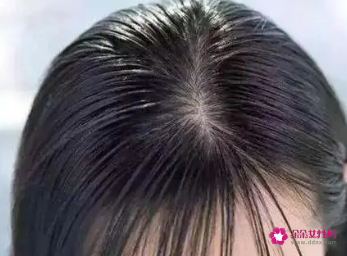 如何让头发变多变厚