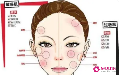 敏感肌肤的特征