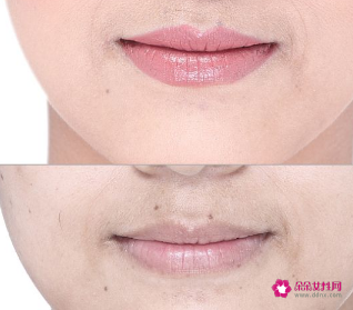 女生唇毛重怎么改善