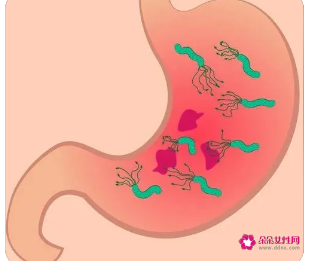 为什么不建议杀幽门螺杆菌