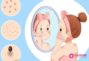 色斑是怎么形成的原因