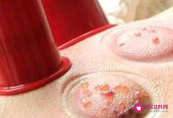 女性去湿气拔罐位置