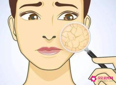 冬天身体皮肤干燥怎么改善