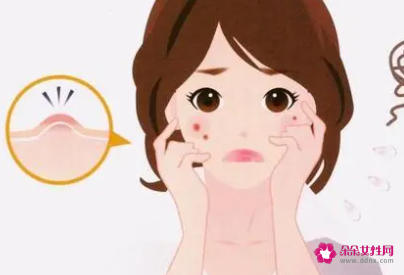 敏感肌护肤步骤