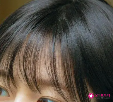 发际线高可以不留刘海吗