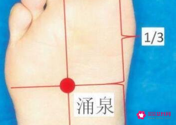 女性去湿气拔罐位置