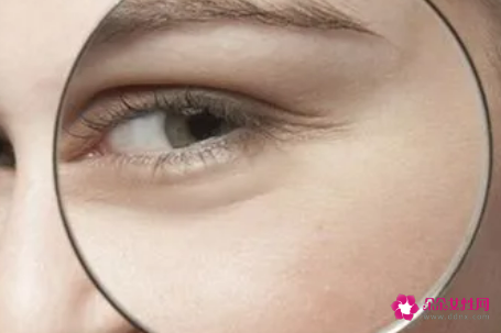 妙招轻松去眼袋