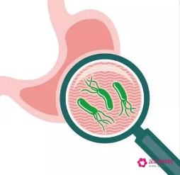 为什么不建议杀幽门螺杆菌