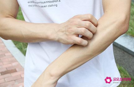 什么人不能吃牛肉