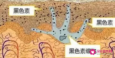 皮肤黑色素代谢不出去是什么原因