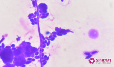 蛋白低有什么症状吃什么药