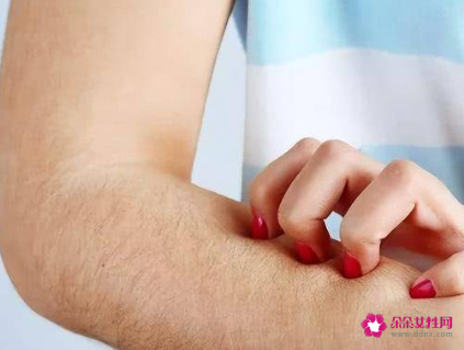 身体痒越抓越痒怎么治