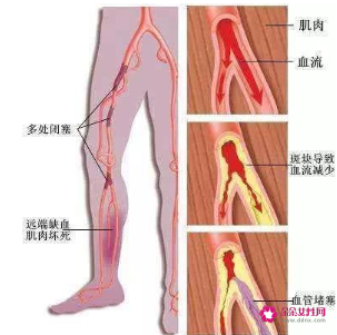 女生天天躺着对身体的危害