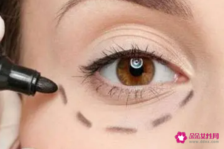 妙招轻松去眼袋