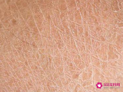 冬天身体皮肤干燥怎么改善