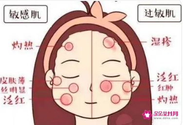 敏感肌肤的特征
